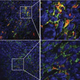 Microscopic images show the macrophage immune cells (the colorful splotches) proliferating and working in cancerous cells. (Image: Jin Hai Zheng et al., 2017)